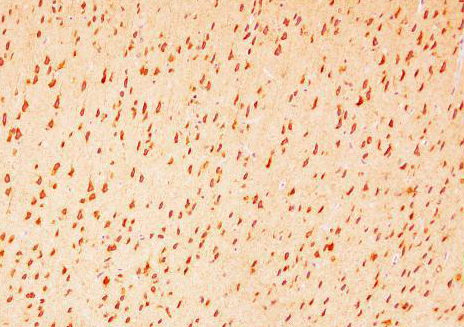 HRH3 antibody (AB21-10137) 1-100 in IHC of Rat Brain